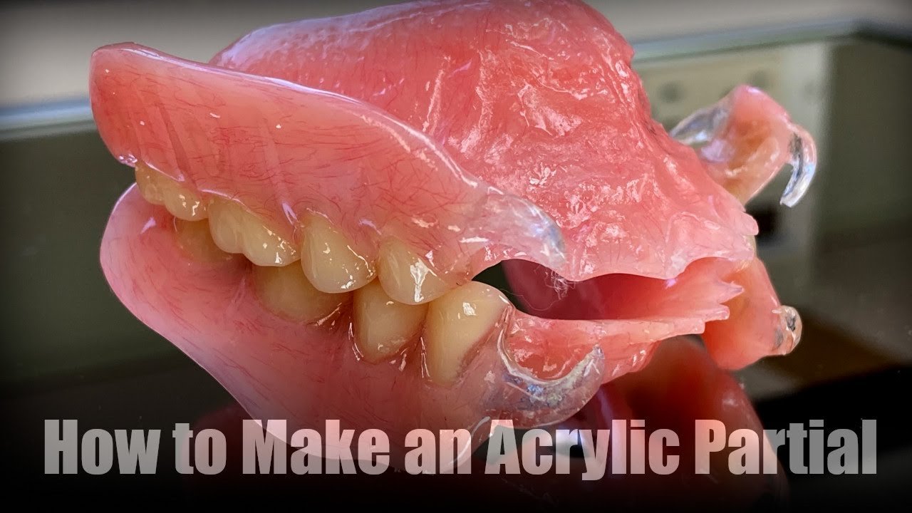 How to Make a Partial Denture