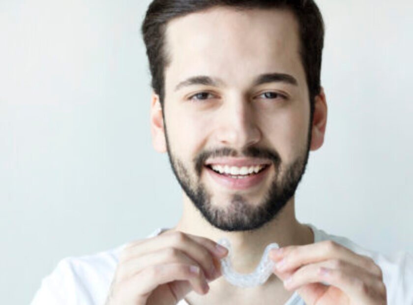 Close-up Of A Man's Hand Putting Transparent Aligner In Teeth