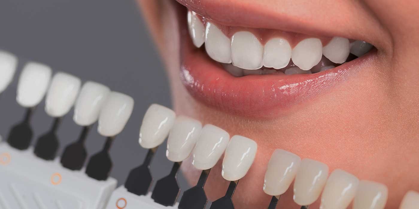 DENTAL-IMPLANT