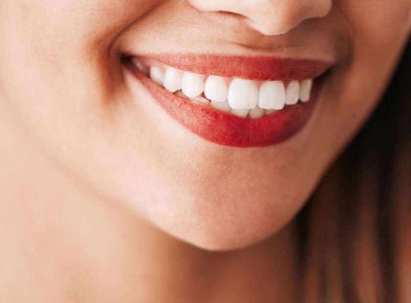 cosmetic teeth whitening