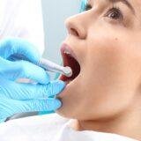 Root canal front tooth