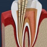 Endodontic Specialists