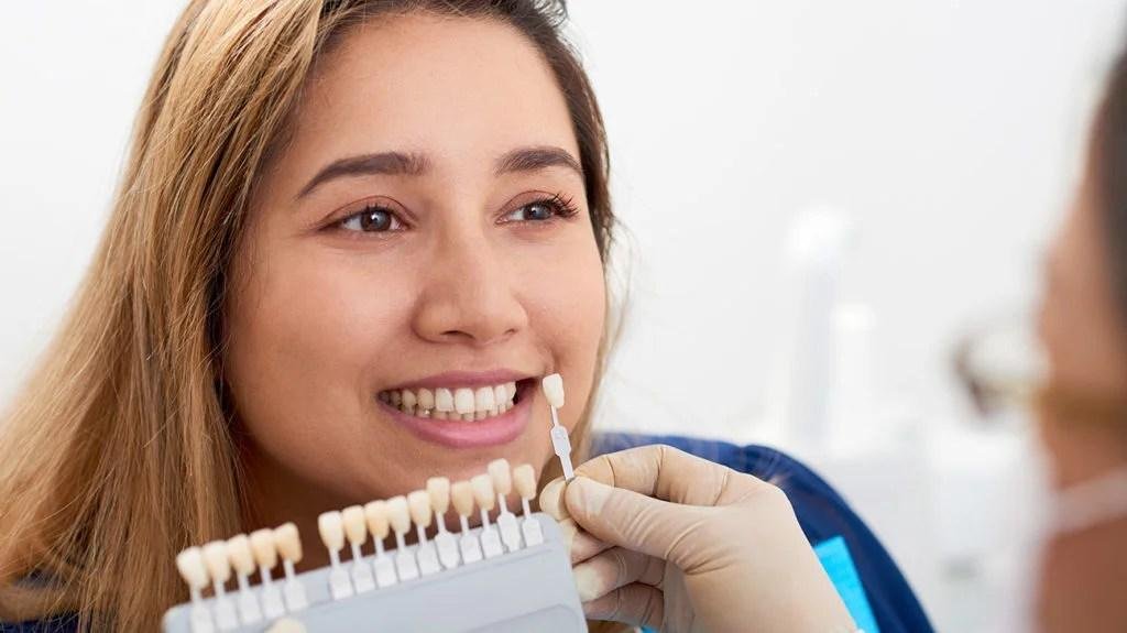 Dental Veneer Services  