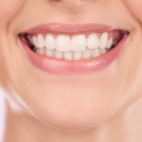 Does teeth whitening damage enamel