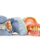 Partial denture front teeth