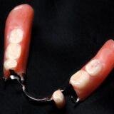 How to clean partial dentures