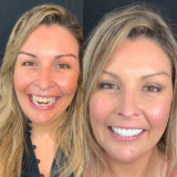 Cosmetic dentistry before and after