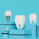 Dental Implants: Complete Guide to Costs and Process