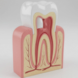 Root Canal Treatment: What to Expect