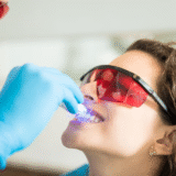 Porcelain Inlays and Onlays in Bolton: A Durable and Aesthetic Alternative to Traditional Fillings